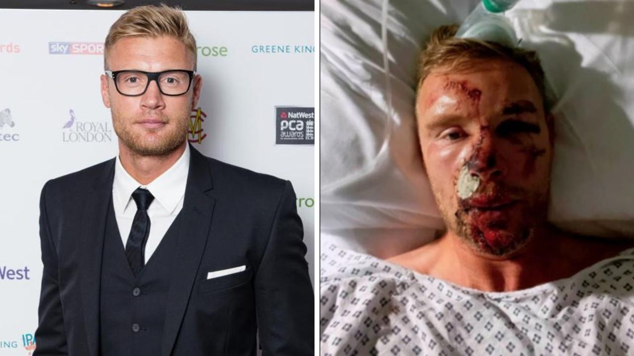 Freddie Flintoff reveals horror photos from Top Gear crash for the first time