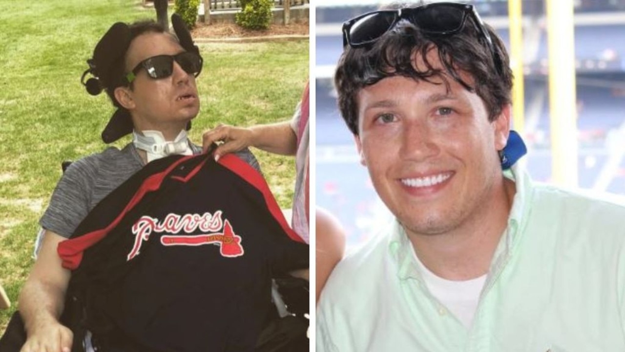 Man's horror ‘locked in' syndrome after error