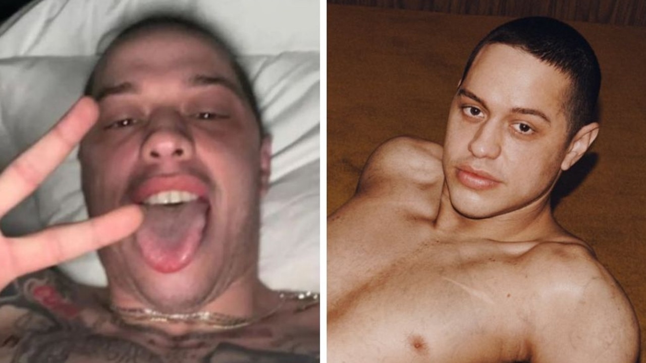 Pete Davidson reveals the insane timeline and cost for removing his 200 tattoos: ‘It's pretty horrible'