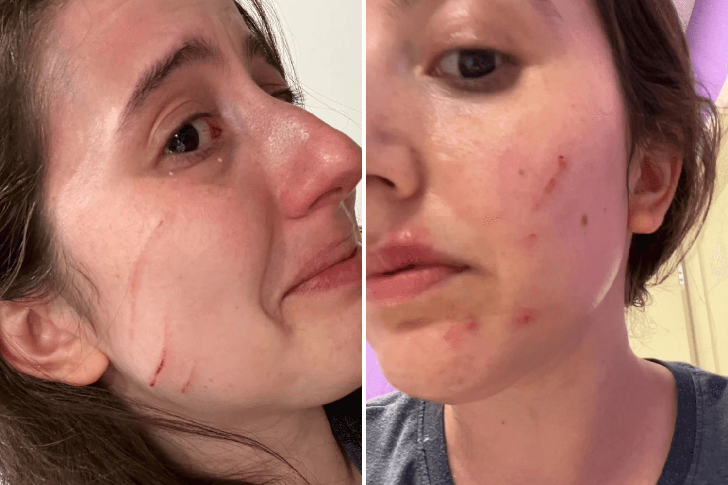 Shelter Worker Steps In To Stop Cats Fighting—Ends Up Scratched and Shaken