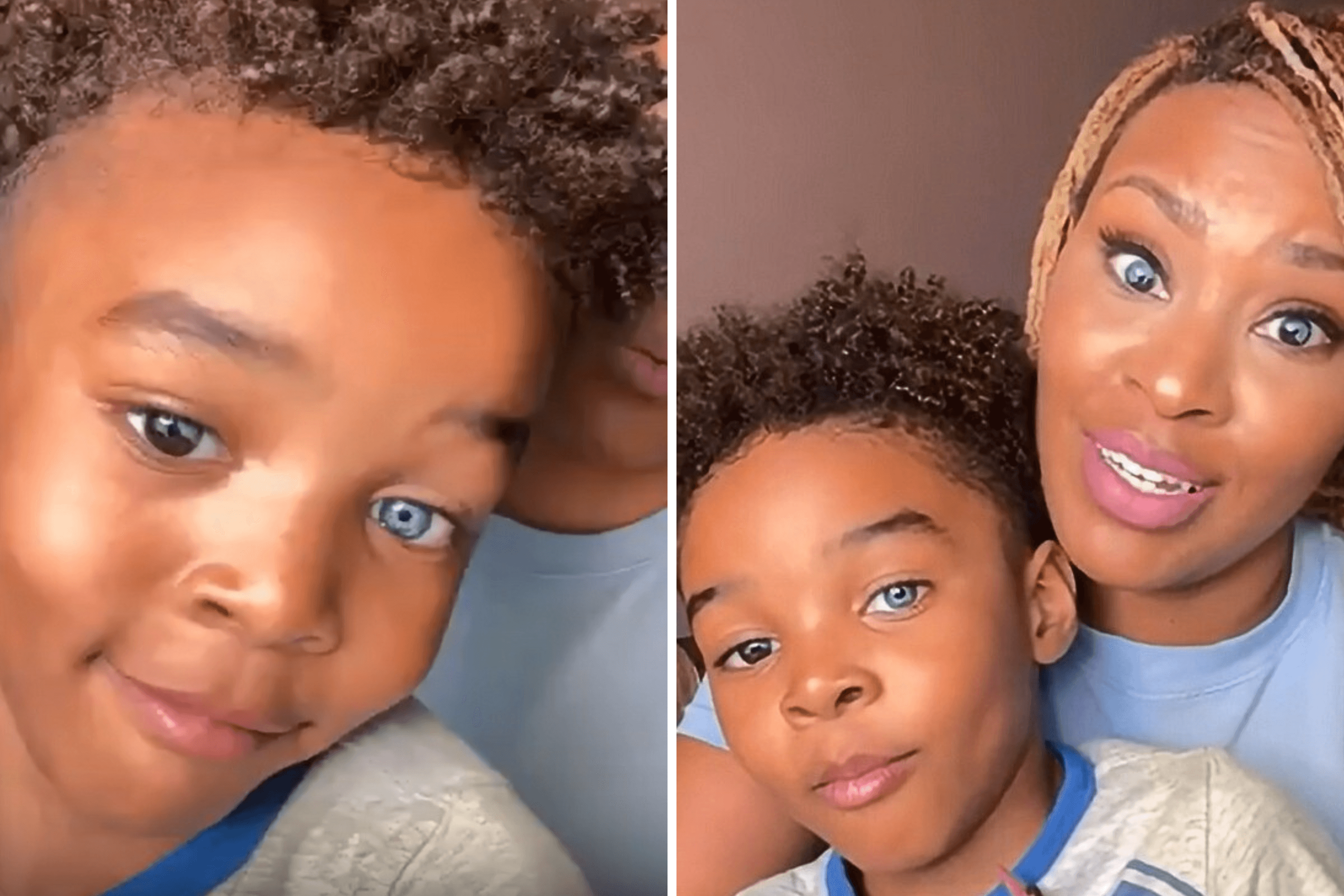 Mom Shares Family's Super Rare Genetic Trait—and the Internet Is 'Jealous'