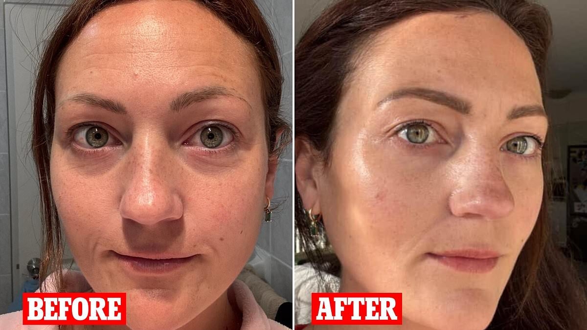 I'm a tired mum of two and was looking exhausted. A $20 buy has given me my best ever skin, I can't believe the difference