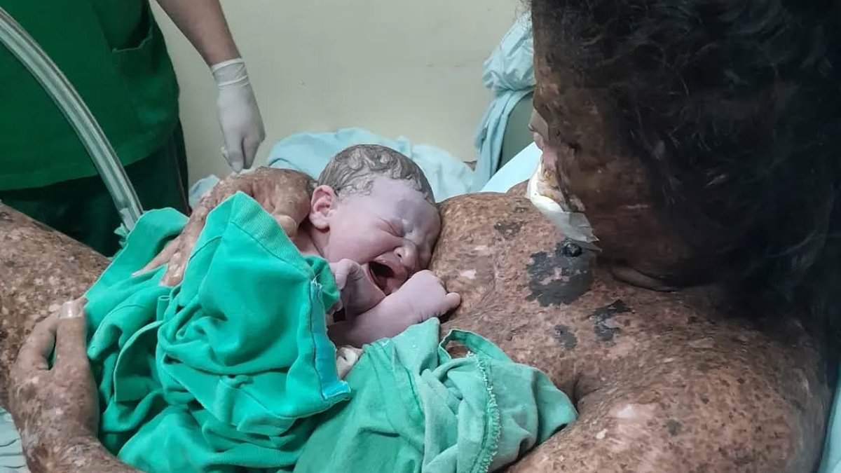 I have a rare skin disease that means I can never go outside - people thought I was 'irresponsible' having a baby but here's what it's really like for me to have a family