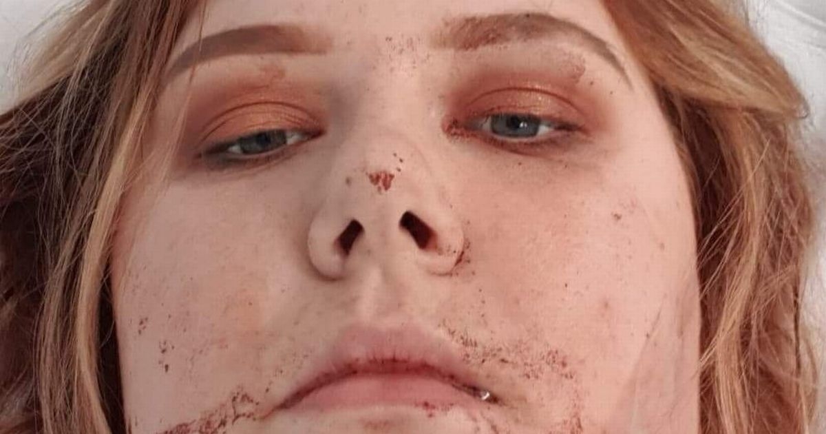 Woman catapulted from funfair ride at 60mph 'lucky to be alive'