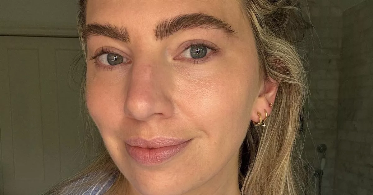 ‘This new vitamin C serum is the only one that doesn't irritate my problem skin'