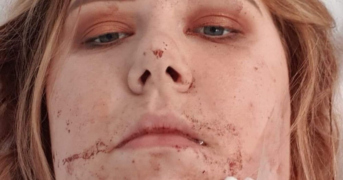 'I was thrown from a fairgound ride at 60mph, I'm lucky to be alive'