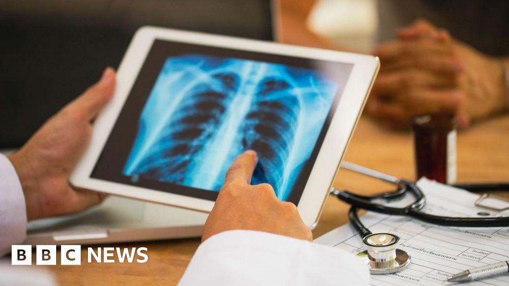 Hull expert sounds warning over rise in tuberculosis cases