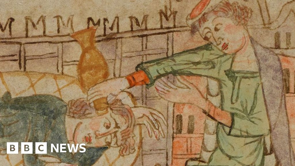 Cambridge University exhibition reveals medieval medical cures