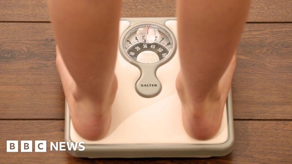 Obesity not an issue for job-seekers, say charities