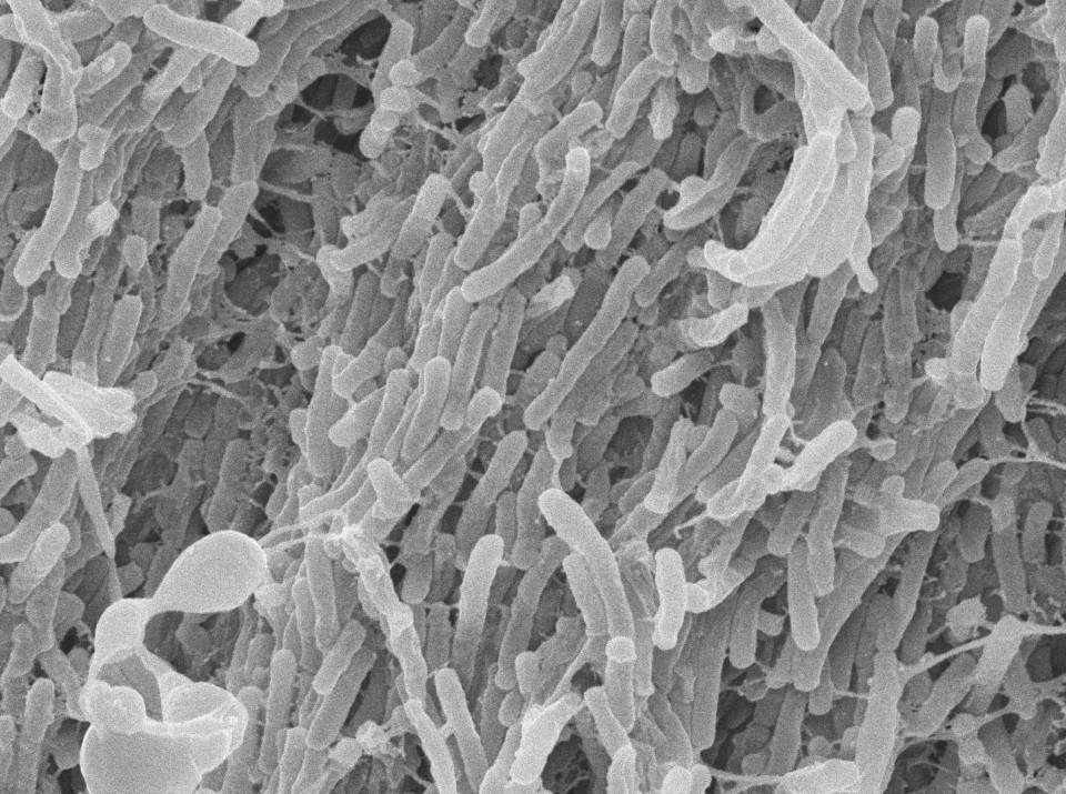 Japan begins pre-entry TB checks for foreigners staying over 3 months