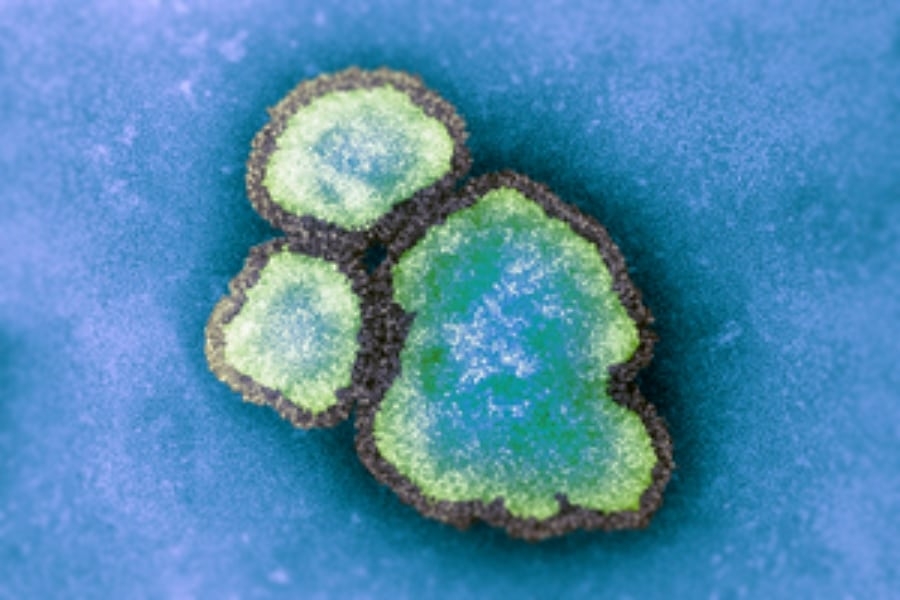 Possible measles exposure at Coca-Cola Coliseum concert, warns Toronto Public Health