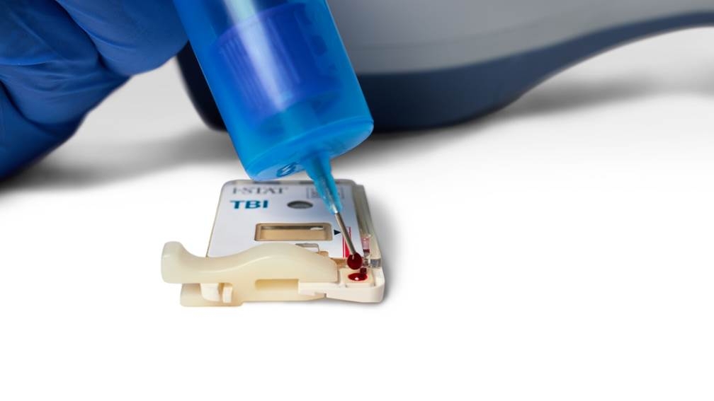 Abbott launches portable concussion blood test in UK