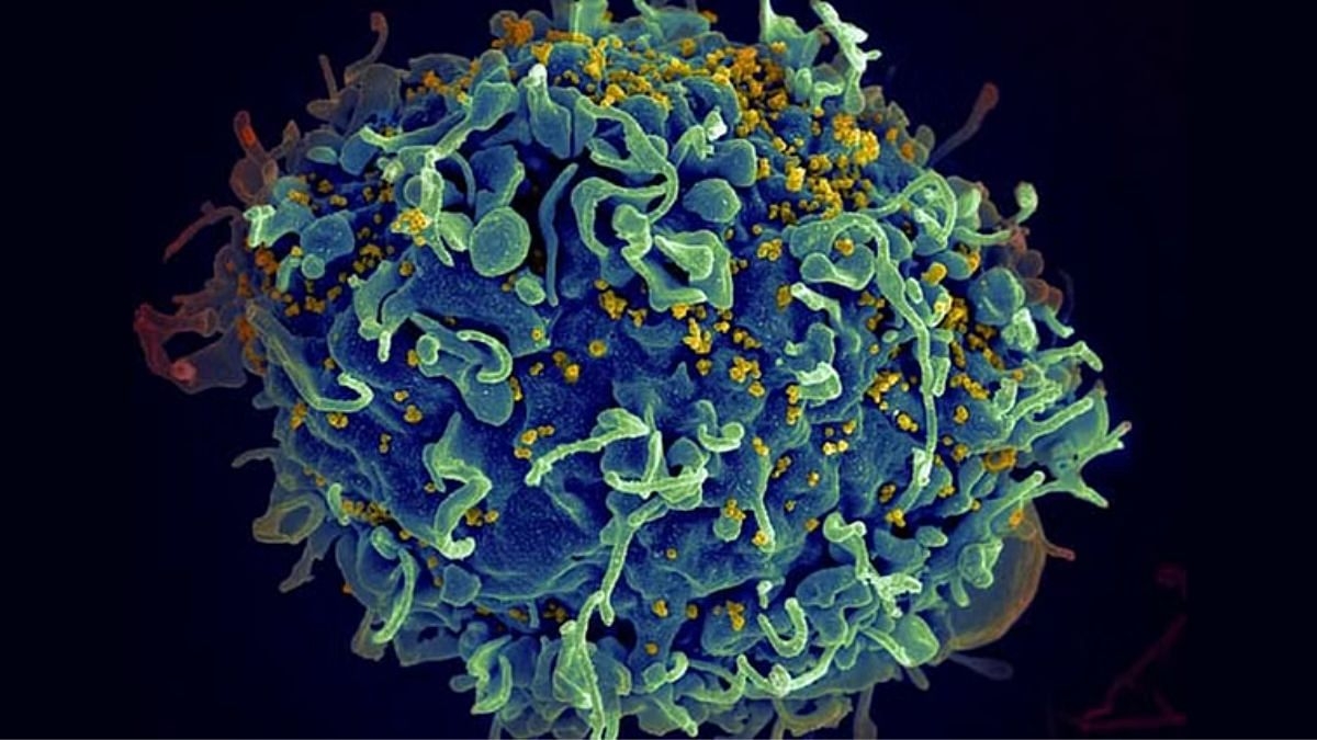 Eliminating AIDS has been an uphill battle. But Melbourne researchers just got one step closer