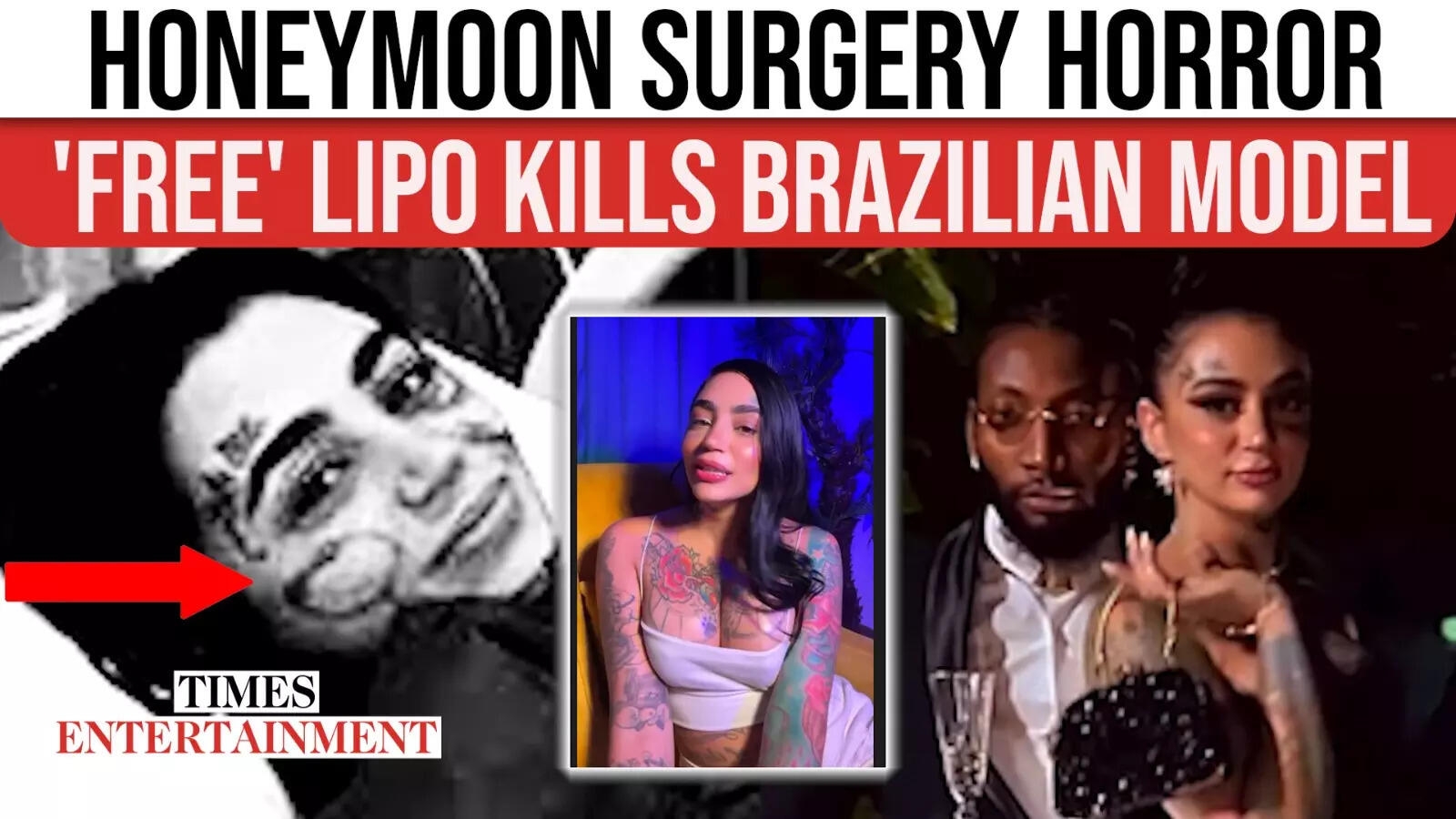 Brazilian Model Ana Buhr Dies After ‘Free' Liposuction On Honeymoon
