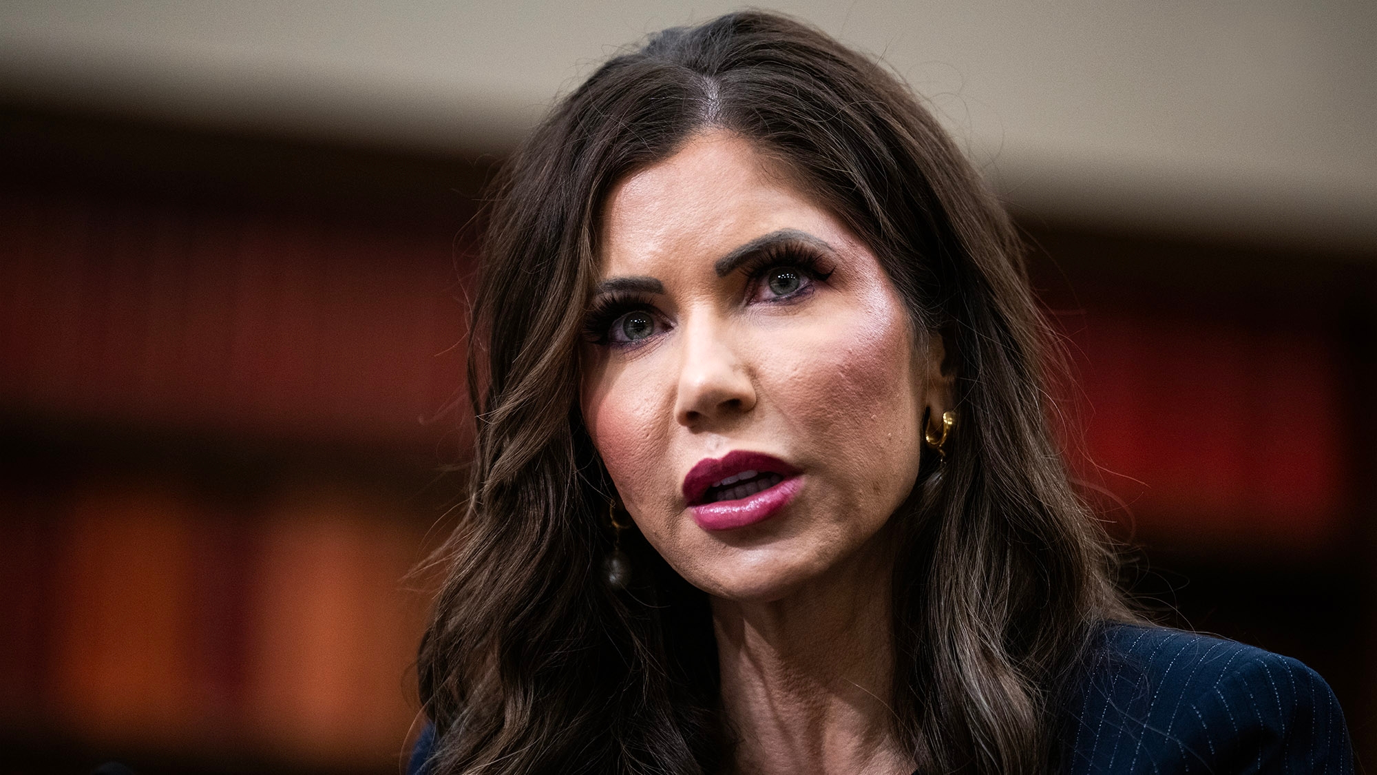Allergic Swelling Leaves Kristi Noem's Face Completely Recognizable