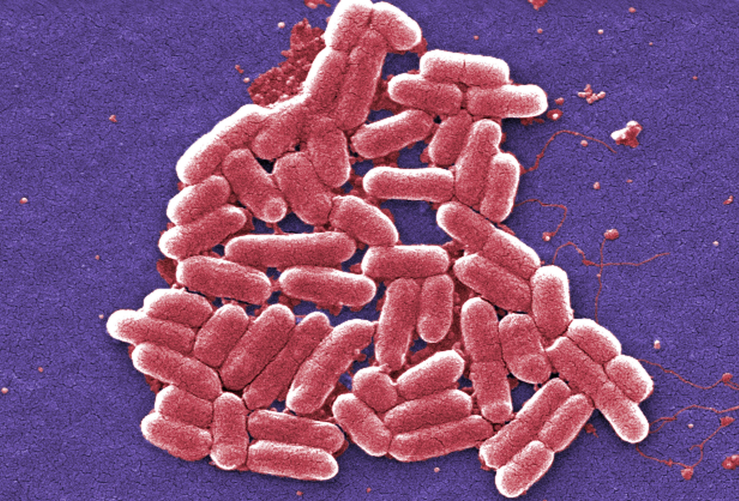 Breakthrough Antibiotic to Combat Deadly Superbug Advances